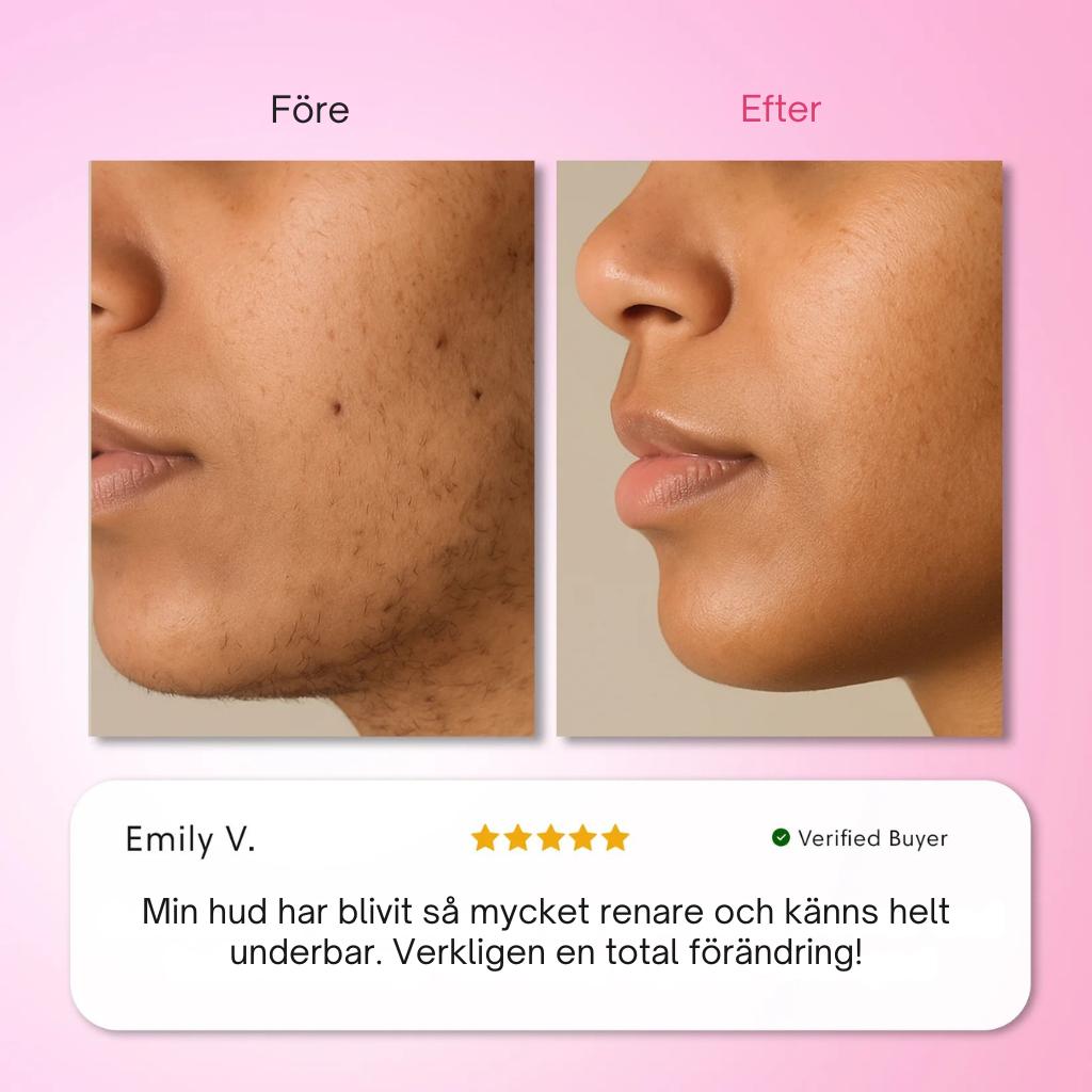 Luxirelle Trilogy Kit — Sluta raka. För alltid.